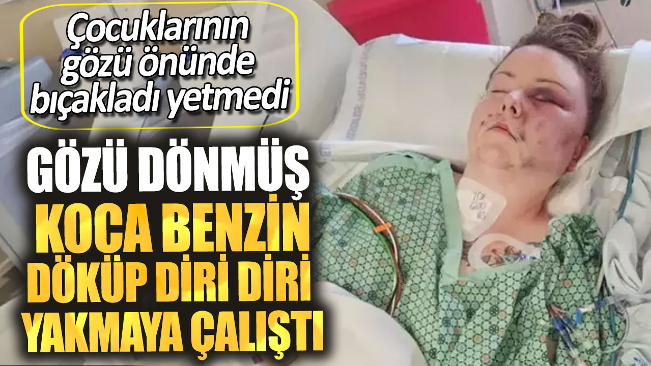 Çocuklarının gözü önünde bıçakladı yetmedi. Gözü dönmüş koca benzin döküp diri diri yakmaya çalıştı