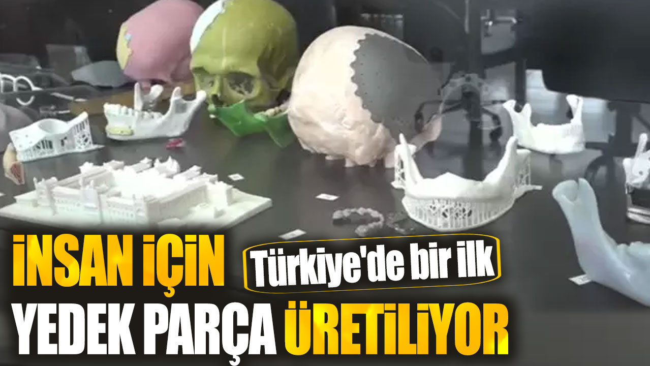 Türkiye'de bir ilk. İnsan için yedek parça üretiliyor