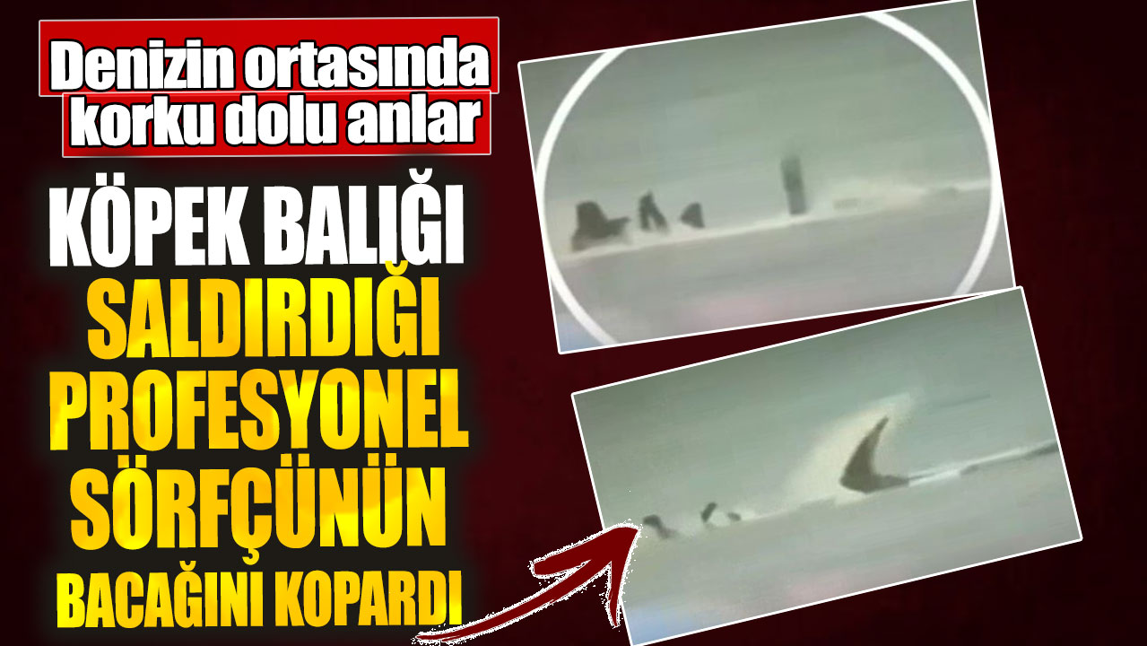 Köpek balığı saldırdığı profesyonel sörfçünün bacağını kopardı. Denizin ortasında korku dolu anlar