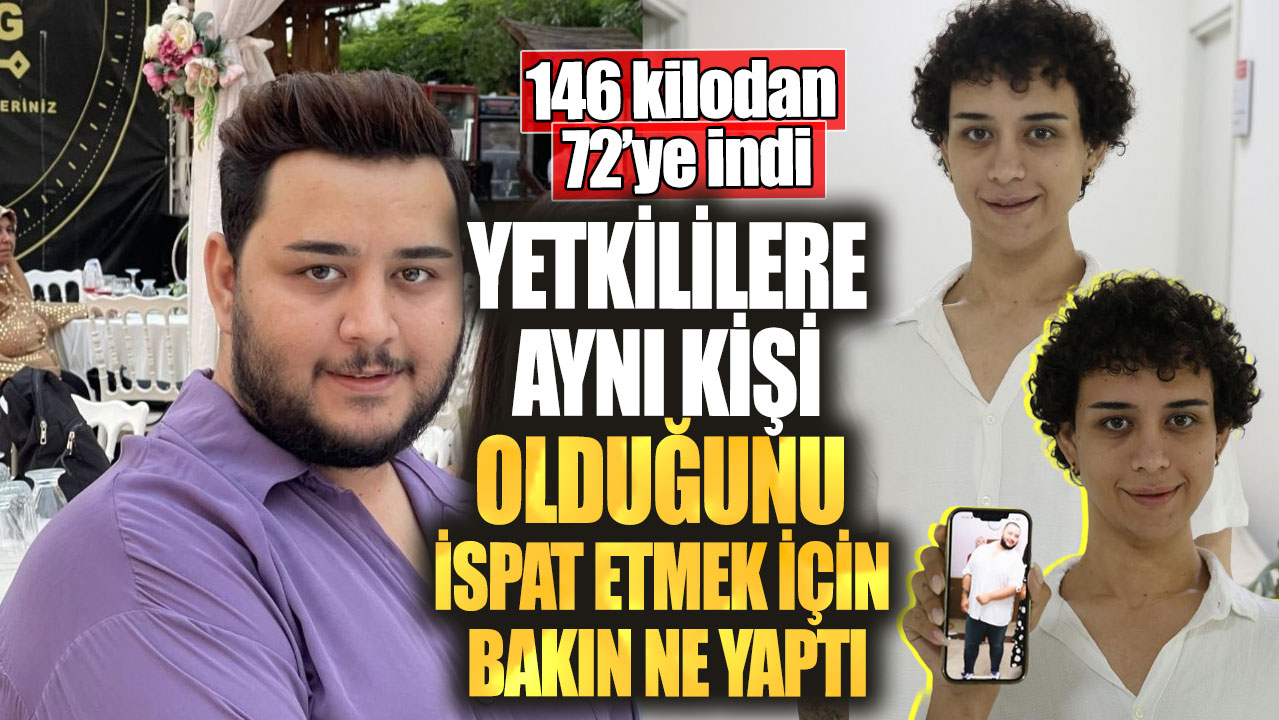 146 kilodan 72’ye indi! Yetkililere aynı kişi olduğunu ispat etmek için bakın ne yaptı