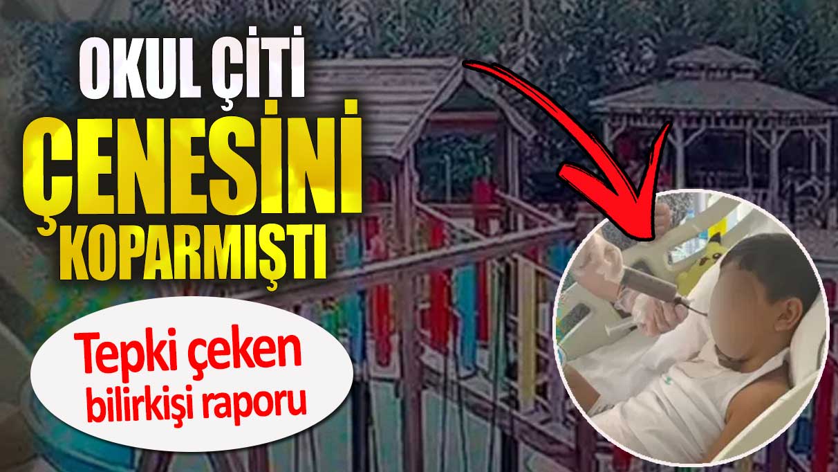 Okul çiti çenesini koparmıştı. Tepki çeken bilirkişi raporu