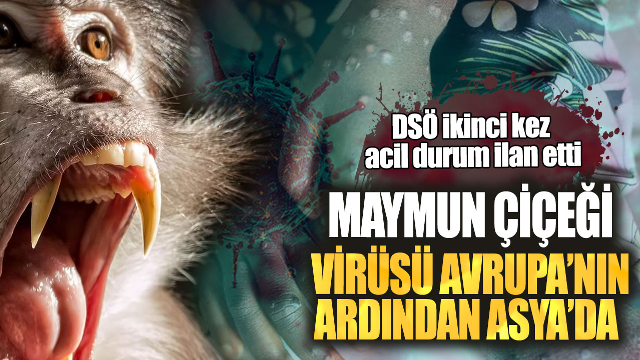 DSÖ ikinci kez acil durum ilan etti! Maymun çiçeği virüsü Avrupa’nın ardından Asya'da