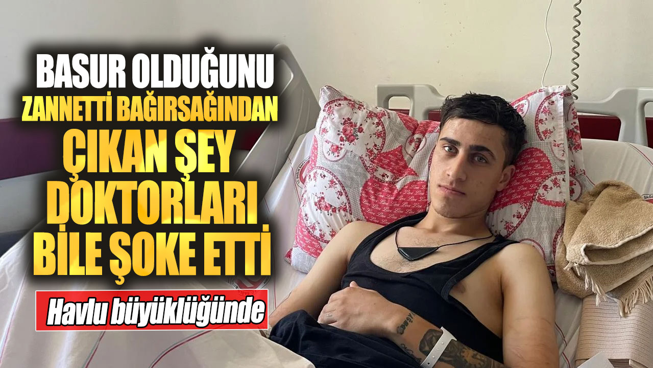 Basur olduğunu zannetti bağırsağından çıkan şey doktorları bile şoke etti! Havlu büyüklüğünde