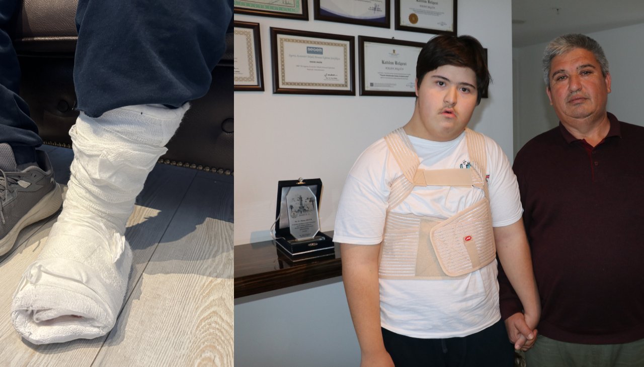 Down sendromlu çocuğu acımasızca darbetti! O cani adli kontrolle serbest