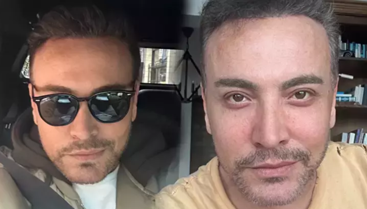 Cenk Eren estetik ameliyat nedenini açıkladı: 'Böyle görünmek için'