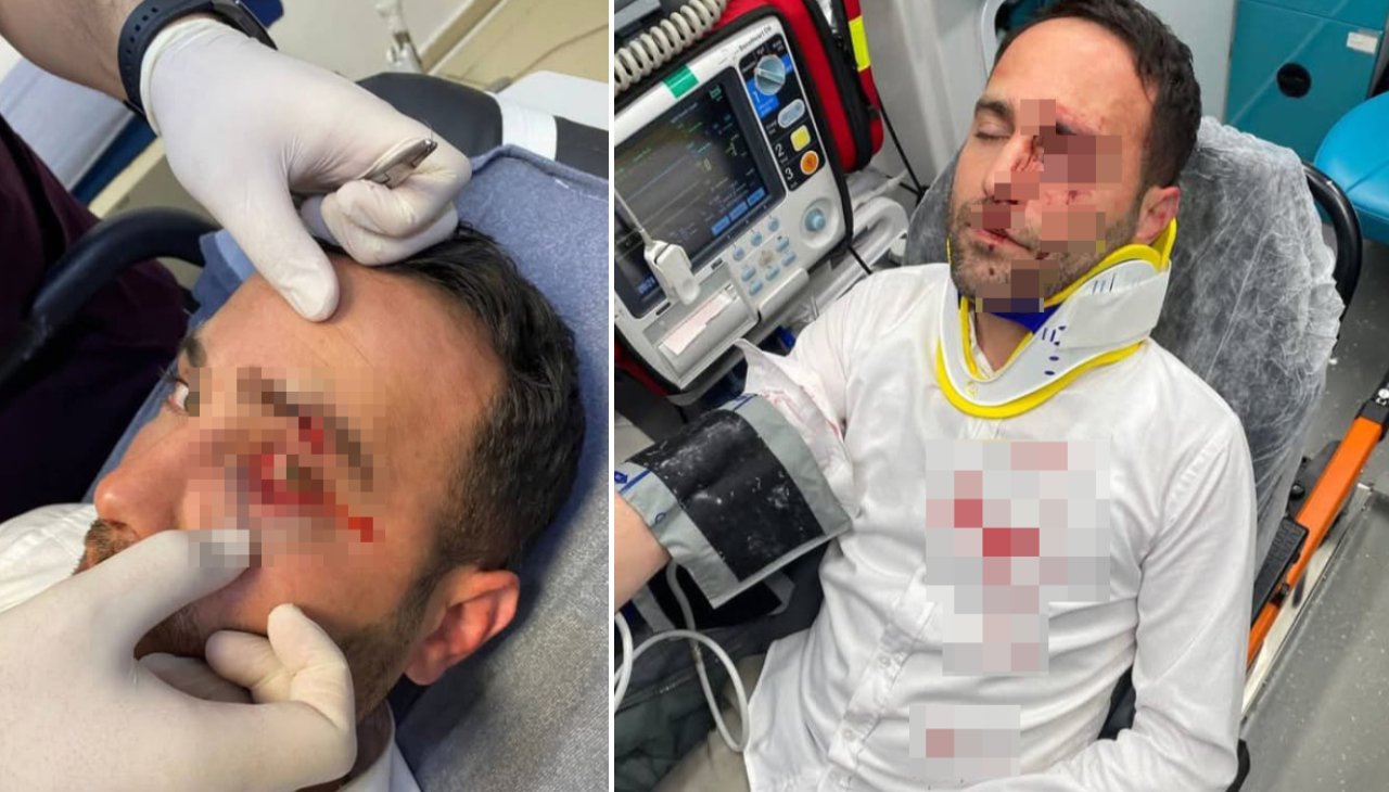 Sinir krizi geçirdi! Komşusu olan imamı telle boğmaya çalıştı