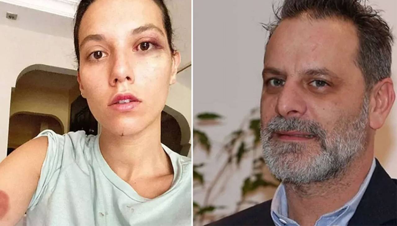 Ozan Güven için 11 yıl 6 ay hapis cezası talebi: Eski sevgiliye darp davasında yeni gelişme