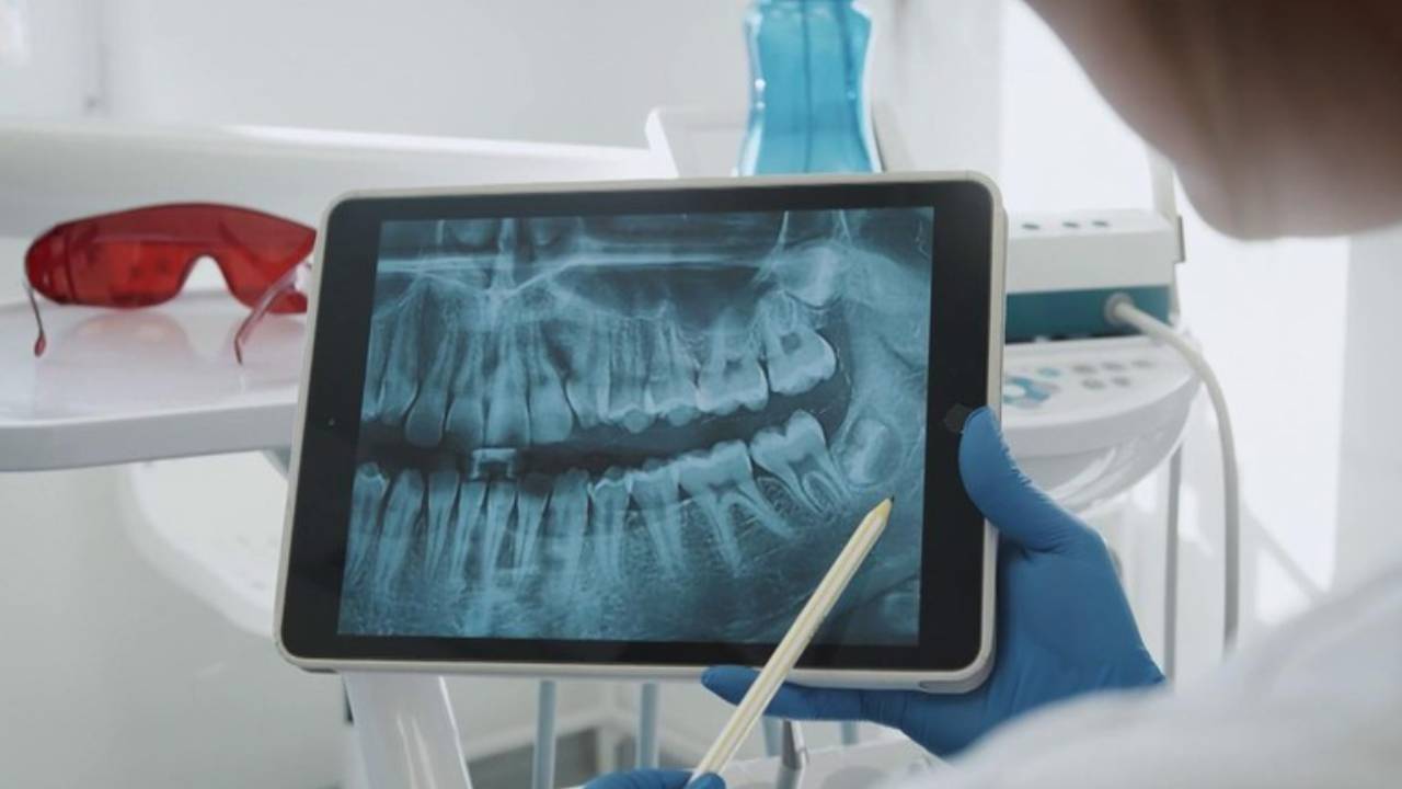 Uzmanından 'İmplant' uyarısı