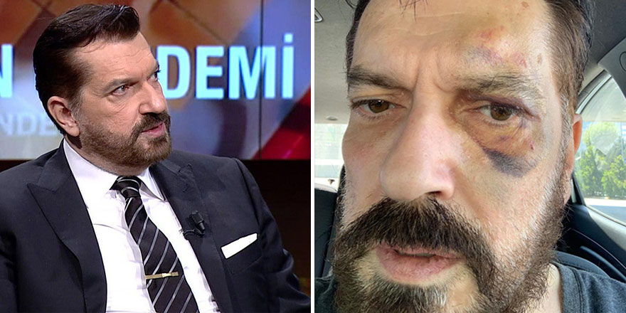 Hakan Bayrakçı uğradığı saldırıyı böyle anlattı: Yiyorsa tek gel dedim