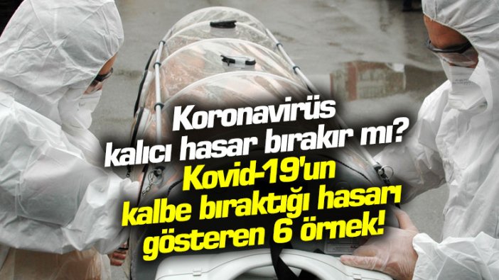 Korona virüs kalıcı hasar bırakır mı? Kovid-19'un kalbe bıraktığı hasarı gösteren 6 örnek!