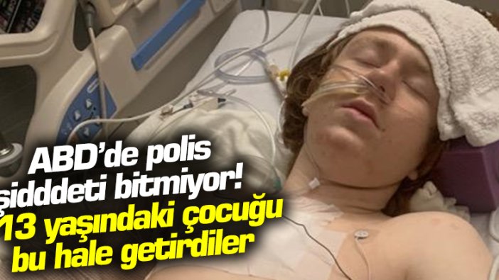 ABD'de polis şiddeti bitmiyor! 13 yaşındaki çocuğu bu hale getirdiler