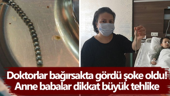 Doktorlar bağırsakta gördü şoke oldu! Anne babalar dikkat büyük tehlike