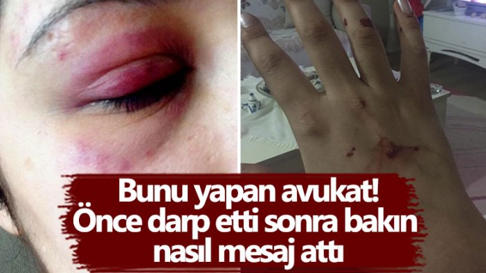 Karabük'te avukat S.A. arkadaşı B.Ü.'yü darp etti! Korku dolu anlar