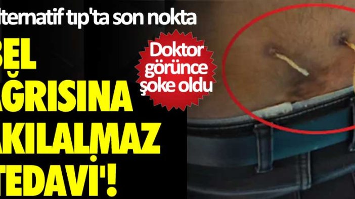 'Alternatif tıp'ta son nokta... Doktor görünce şoke oldu!  Bel ağrısına akılalmaz 'tedavi'