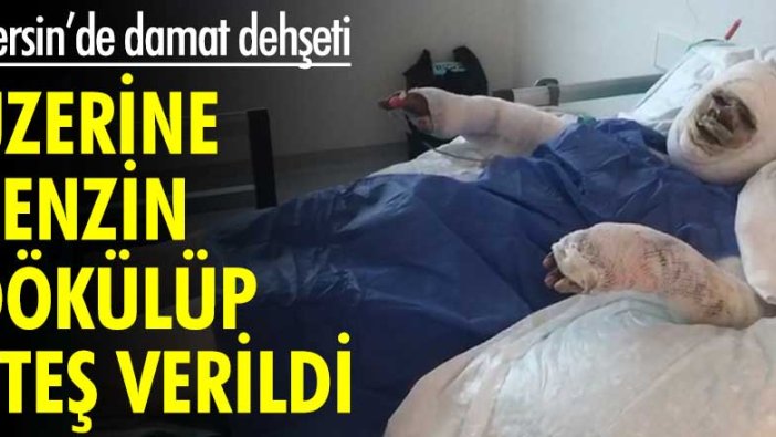 Mersin'de kayınvalidesini benzin dökerek ateşe verdi! Kan donduran olay