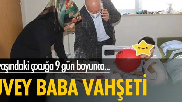 Üvey baba vahşeti! 4 yaşındaki çocuğa 9 gün boyunca...