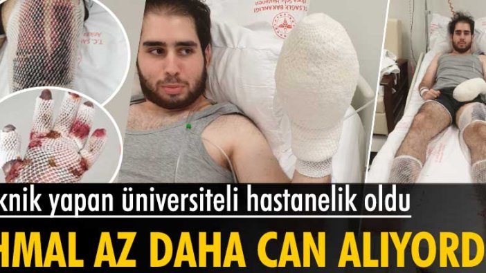 Ankara’da piknik yapan Doruk Özcan az daha canından oluyordu