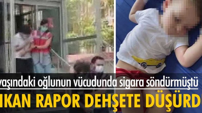 Adli Tıp raporu dehşeti ortaya çıkardı! 2 yaşındaki çocuğa akıl almaz işkence