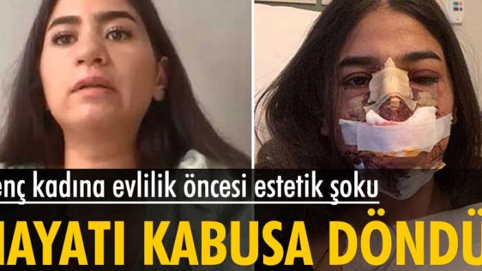 Avusturya'dan İstanbul'a gelen Güllü Gökçe'ye evlilik öncesi estetik şoku