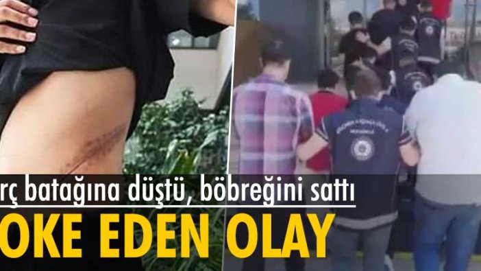 Şoke eden olay! Borç batağına düştü, böbreğini sattı