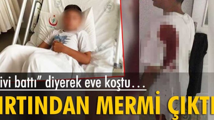 “Çivi battı” diyerek eve koşan çocuğun sırtından mermi çıktı!