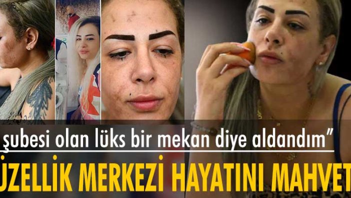 Güzellik merkezinde yüzü yandı, suç üstüne kaldı