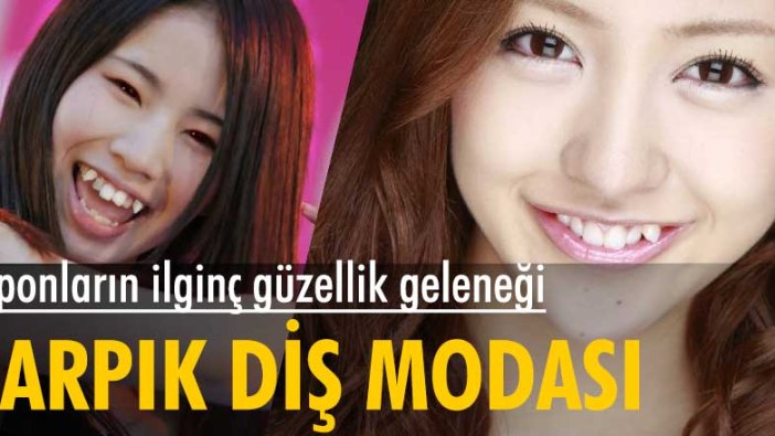 Japonların ilginç güzellik geleneği: Çarpık diş modası