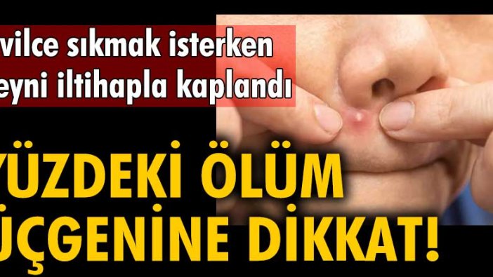 Yüzdeki ölüm üçgenine dikkat! Sivilce sıkmak isterken beyni iltihapla kaplandı