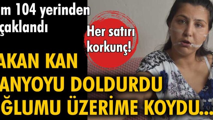 Aysel Perkgün tam 104 yerinden bıçaklandı! Yaşadığı dehşeti anlattı