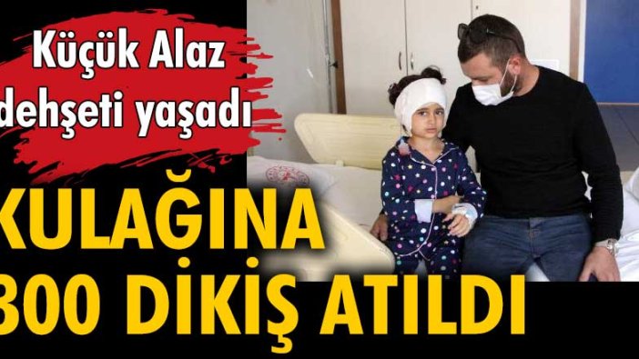 4 yaşındaki Alaz köpek saldırısı sonucunda kulağını kaybediyordu tam 300 dikiş...