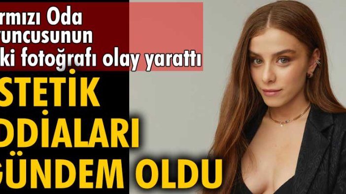 İlayda Alişan'ın eski fotoğrafı olay yarattı! Estetik iddiaları gündem oldu