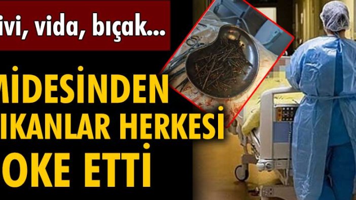 Litvanya'da şoke eden operasyon! Midesinden bir kilodan fazla çivi, vida, bıçak çıktı