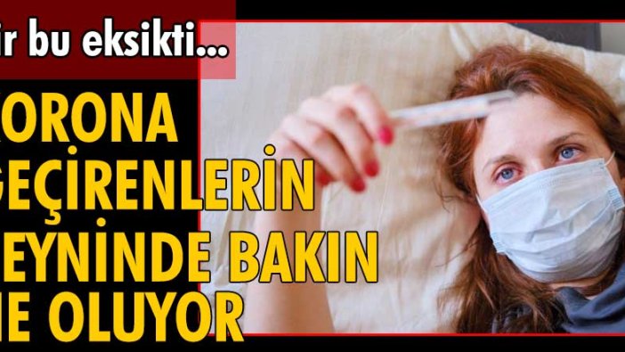 "Kovid-19 geçirenlerin beyninde küçülme tespit edildi"