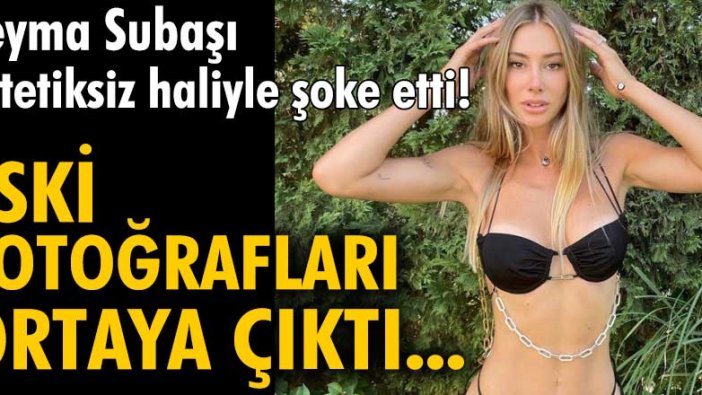 Şeyma Subaşı estetiksiz haliyle şoke etti!