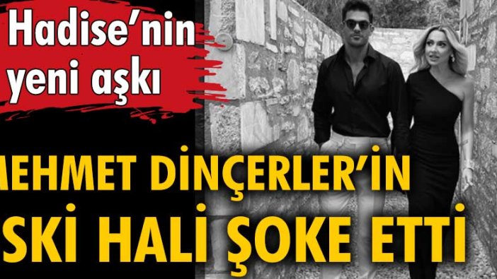 Hadise'nin yeni aşkı Mehmet Dinçerler'in eski halini görenler şoke oldu