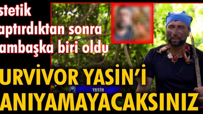 Survivor Yasin estetik yaptırdıktan sonra bambaşka biri oldu. Tanıyamayacaksınız!