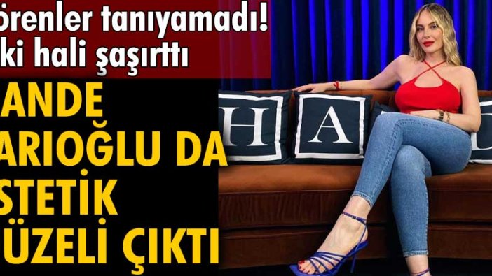 Hande Sarıoğlu da estetik güzeli çıktı!