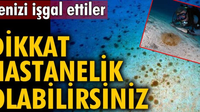 Kaş'ta denizanası istilası