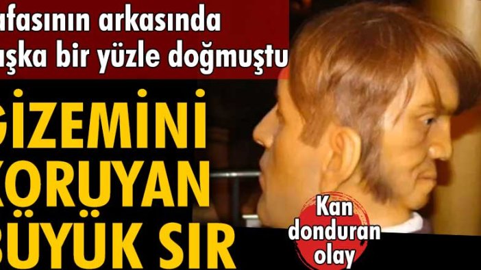 Kafasının arkasında başka bir yüzle doğan Edward Mordake'nin sırrı