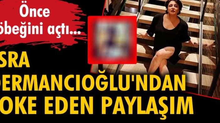 Esra Dermancıoğlu'ndan şoke eden paylaşım! Önce göbeğini açtı...