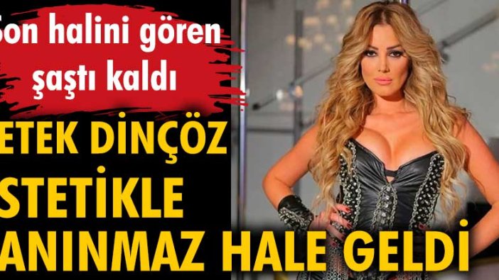 Petek Dinçöz estetikle tanınmaz hale geldi. Son halini gören şaştı kaldı