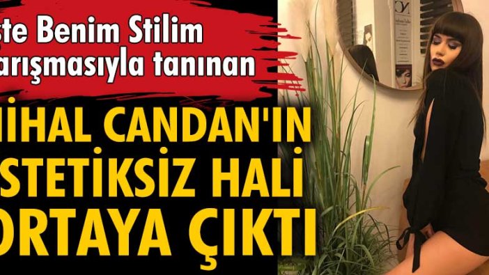 Nihal Candan'ın estetiksiz hali ortaya çıktı!