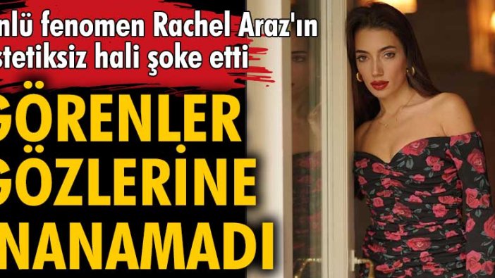 Ünlü fenomen Rachel Araz'ın estetiksiz hali çok şaşırttı