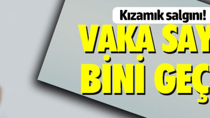 ABD'deki kızamık salgınında vaka sayısı artıyor