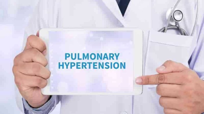 "Pulmoner Hipertansiyon doğru tedavi edilmezse ölümle bitiyor”