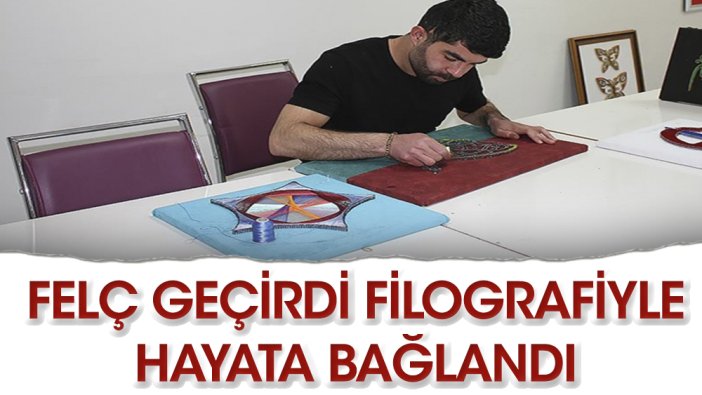 Beyin ameliyatı sonrası felç geçiren genç filografiyle hayata bağlandı