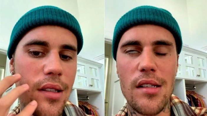 Justin Bieber felç geçirdikten sonra ilk defa konuştu