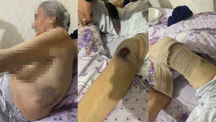 Bakıcıdan yaşlı kadına kan donduran işkence!