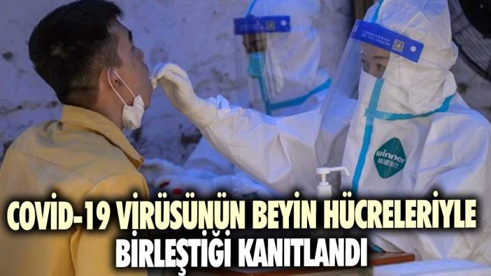 Covid-19 virüsünün beyin hücreleriyle birleştiği kanıtlandı