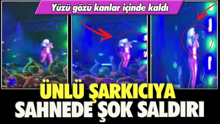 Ünlü şarkıcıya sahnede şok saldırı: Yüzü gözü kanlar içinde kaldı